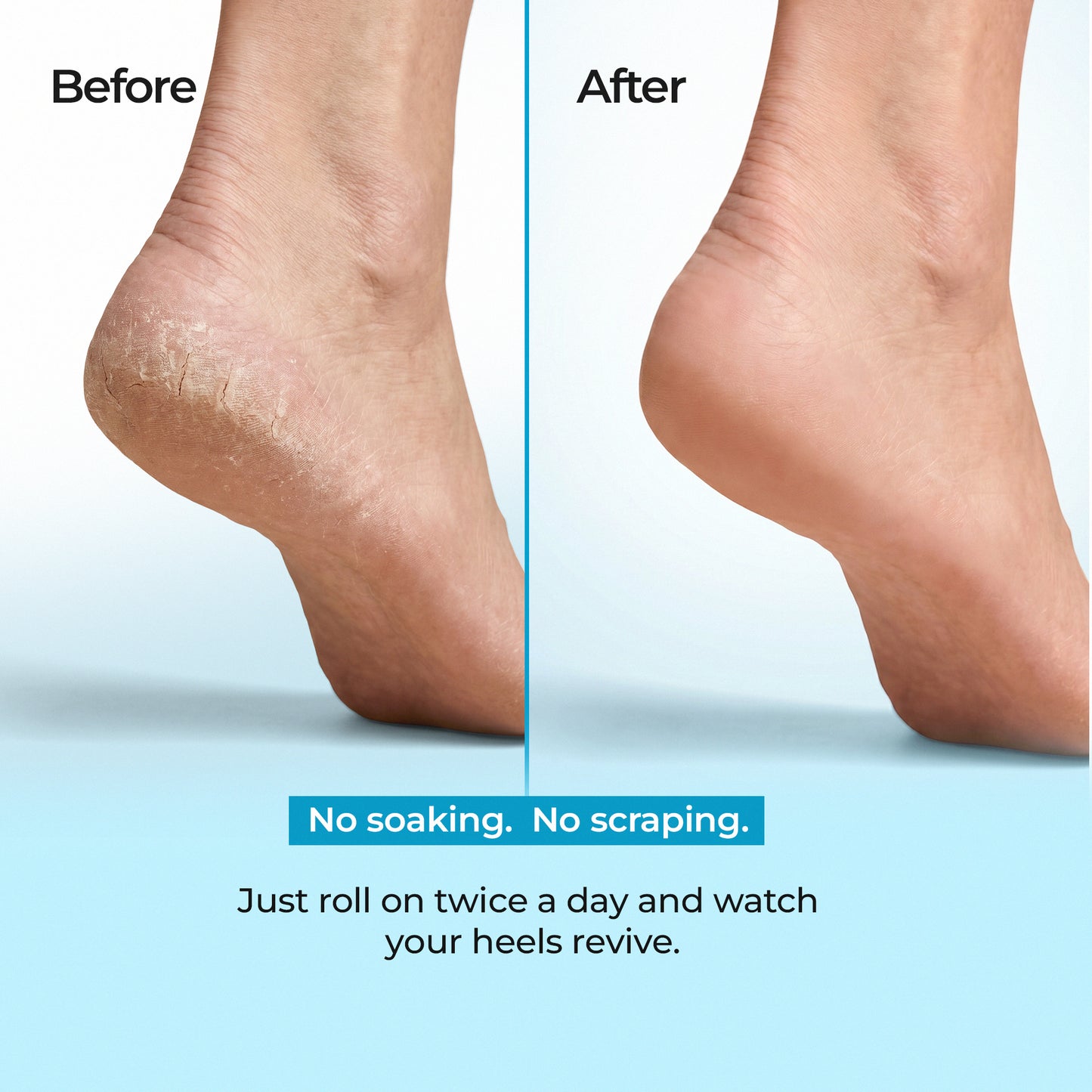 Sole Revival 20% Urea Heel Roll-On
