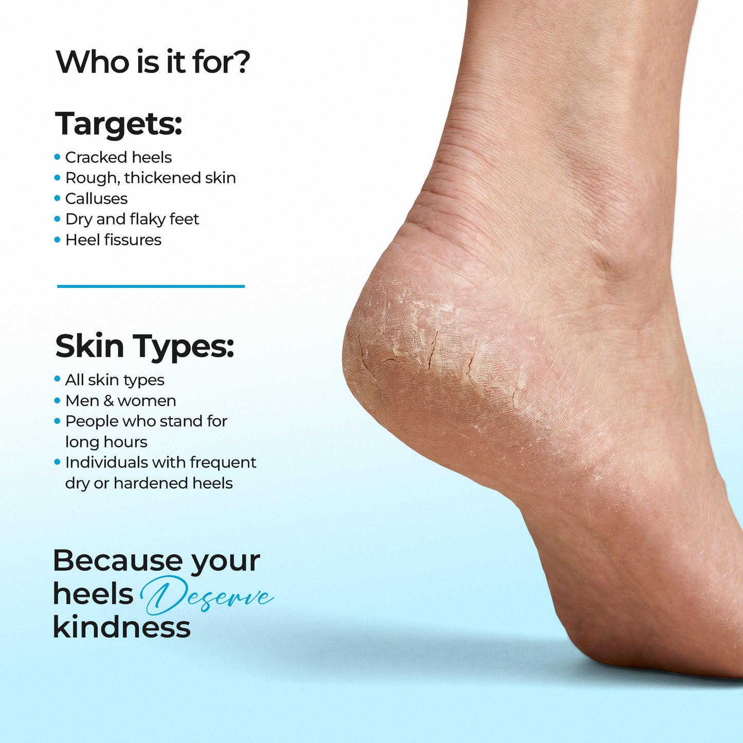 Sole Revival 20% Urea Heel Roll-On